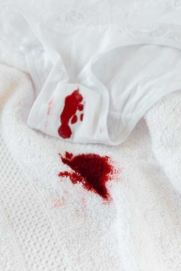 Culotte menstruelle ado : une révolution pour les premières règles